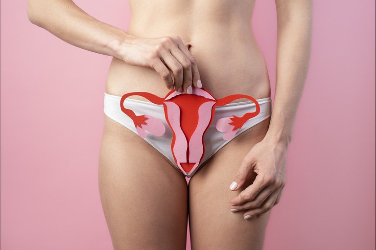Endometriose causa cólica intensa e pode levar à infertilidade
