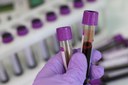 Anvisa desenvolve ações em serviços de hemoterapia em preparação para a COP 30