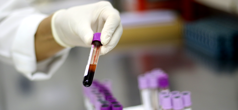 Ministério da Saúde descarta caso de gripe aviária em um trabalhador do Rio Grande do Sul Ministério da Saúde descarta caso de gripe aviária em um trabalhador do Rio Grande do Sul