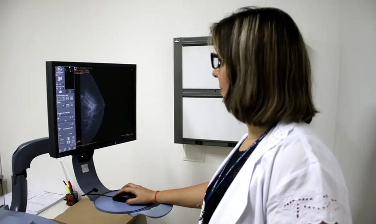 Ministério da Saúde padroniza informações para acesso ao exame de mamografia no SUS Ministério da Saúde padroniza informações para acesso ao exame de mamografia no SUS