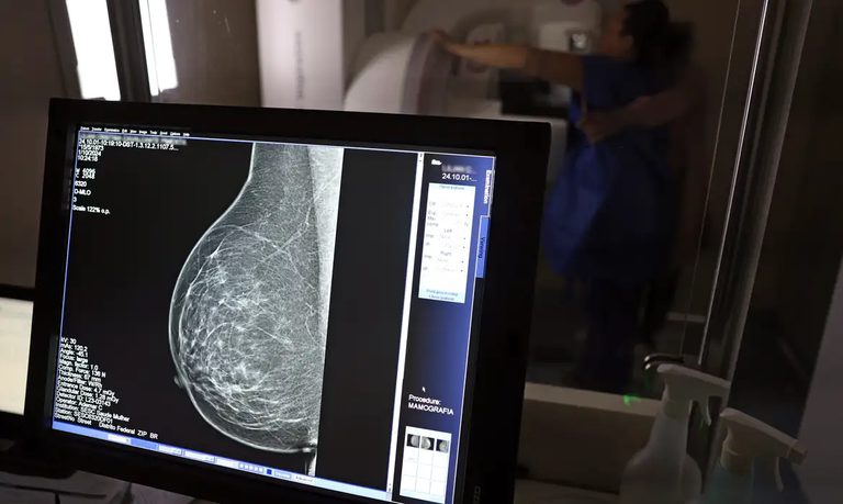 Prevenção e detecção precoce são destaques no Outubro Rosa deste ano