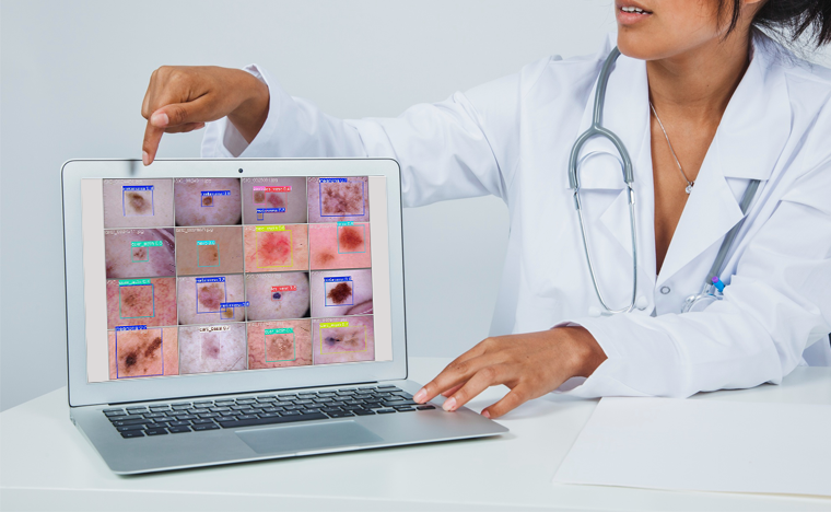 Modelo de IA apoia diagnóstico de câncer de pele